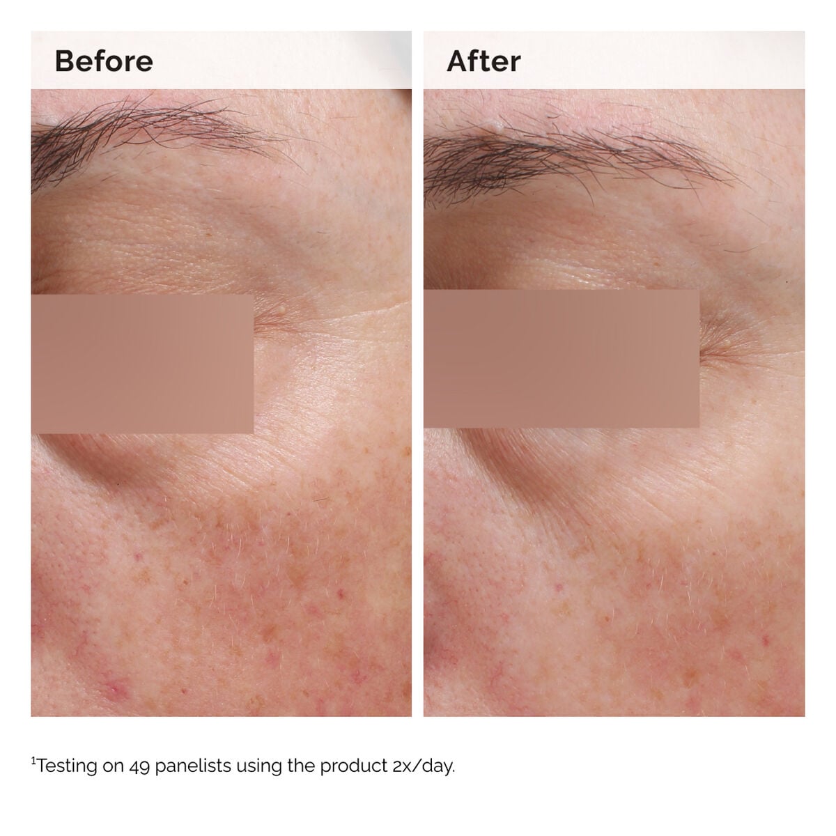 niacinamide-5-face-and-body-emulsion-j7 2024-08-23-ORD-Nia-5pct-Face-Body-B-A-Elasticity-Global-02-1x1.jpg