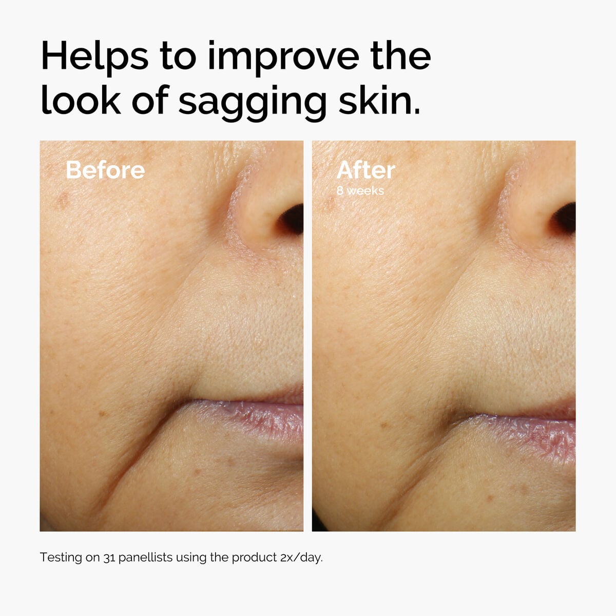 caffeine-3-escin-1-face-serum-s3 ord-caffeine-3pct-escin-1pct-face-serum-before-after-sagging.jpg