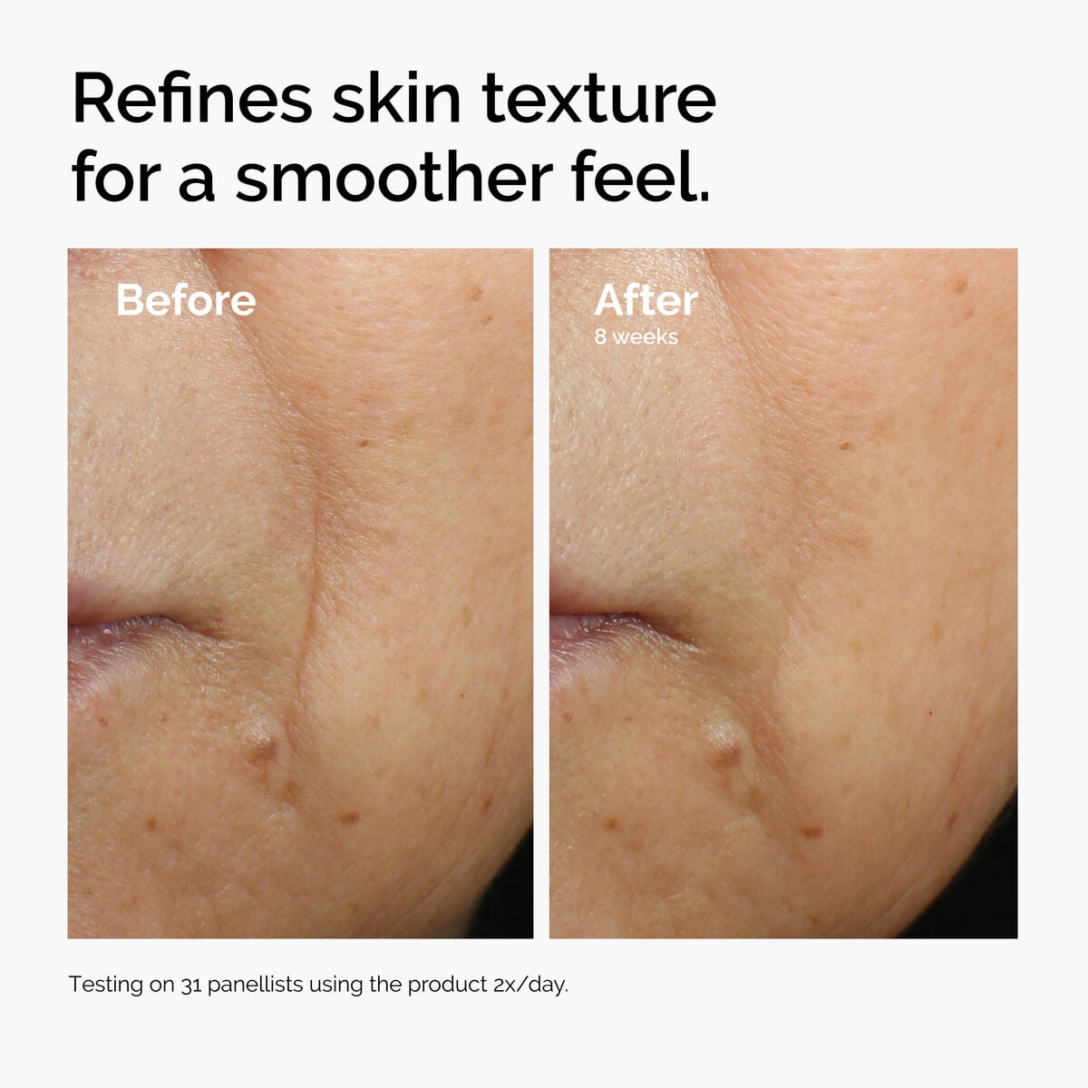 caffeine-3-escin-1-face-serum-s3 ord-caffeine-3pct-escin-1pct-face-serum-before-after-texture.jpg