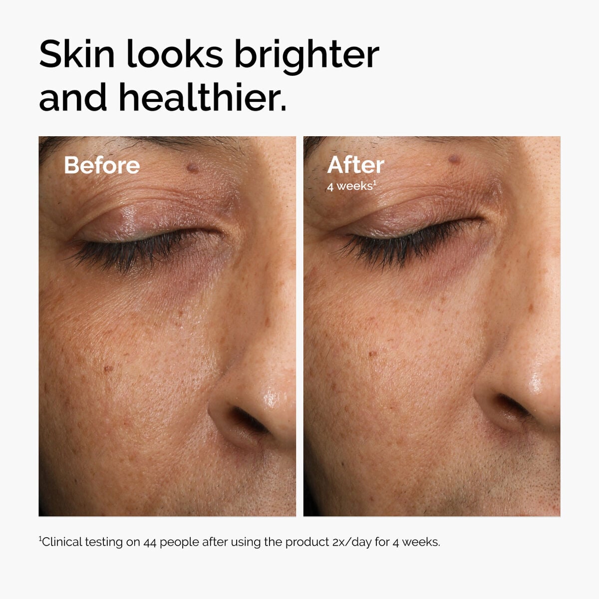 multi-antioxidant-radiance-serum-o7 ord-mars-before-after-healthy.jpg