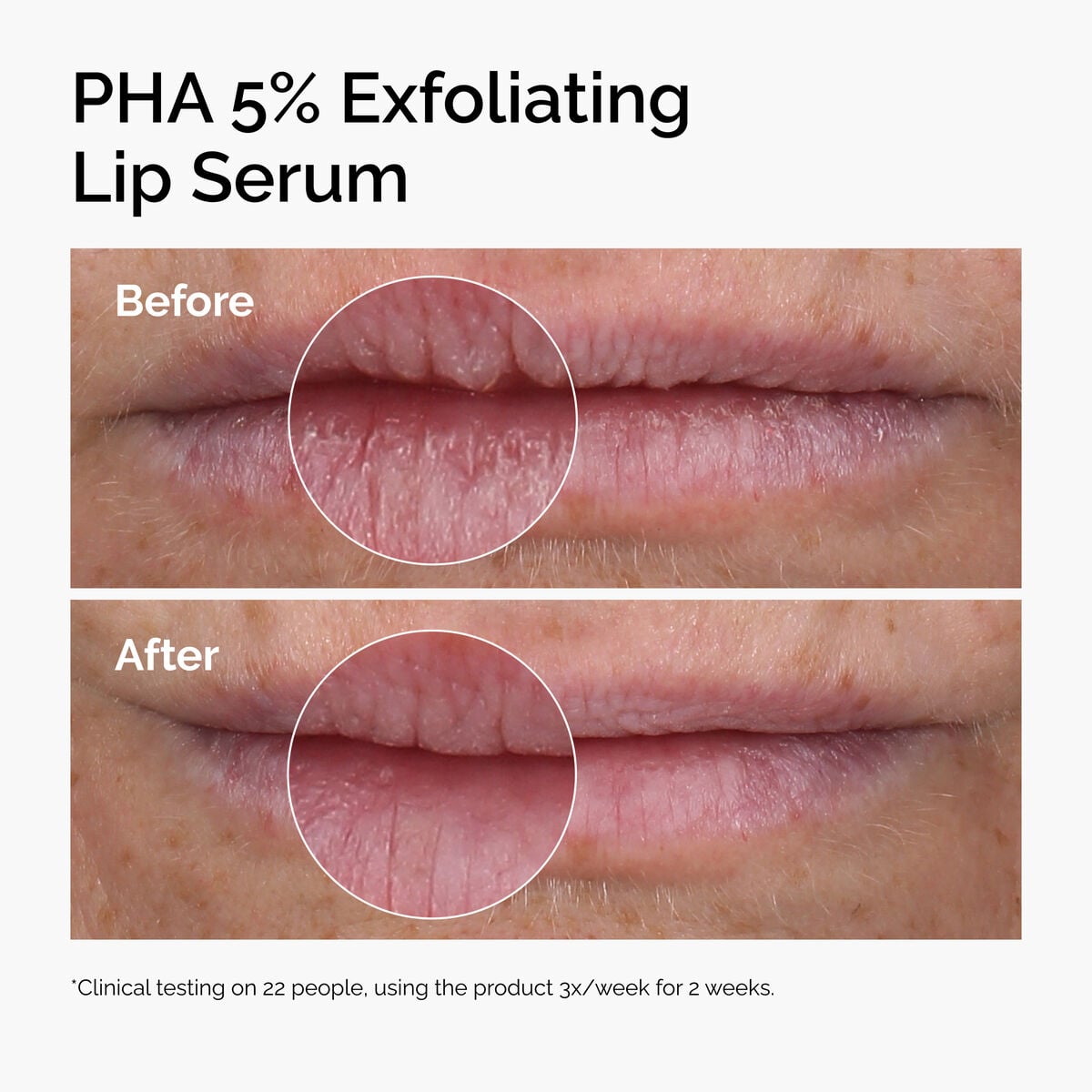 pha-5-exfoliating-lip-serum-l9 ord-pha-5pct-lip-exfoliating-serum-before-after.jpg